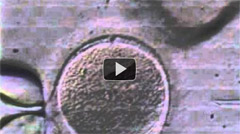 Video: Intracytoplasmic sperm injection (ICSI)